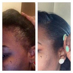 #itworks hair and nails vitamins